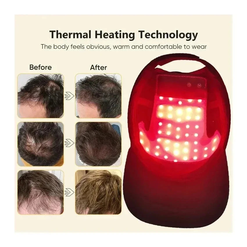 Red Light Hair Growth Cap