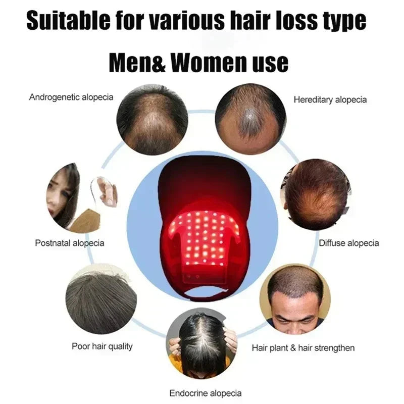 Red Light Hair Growth Cap