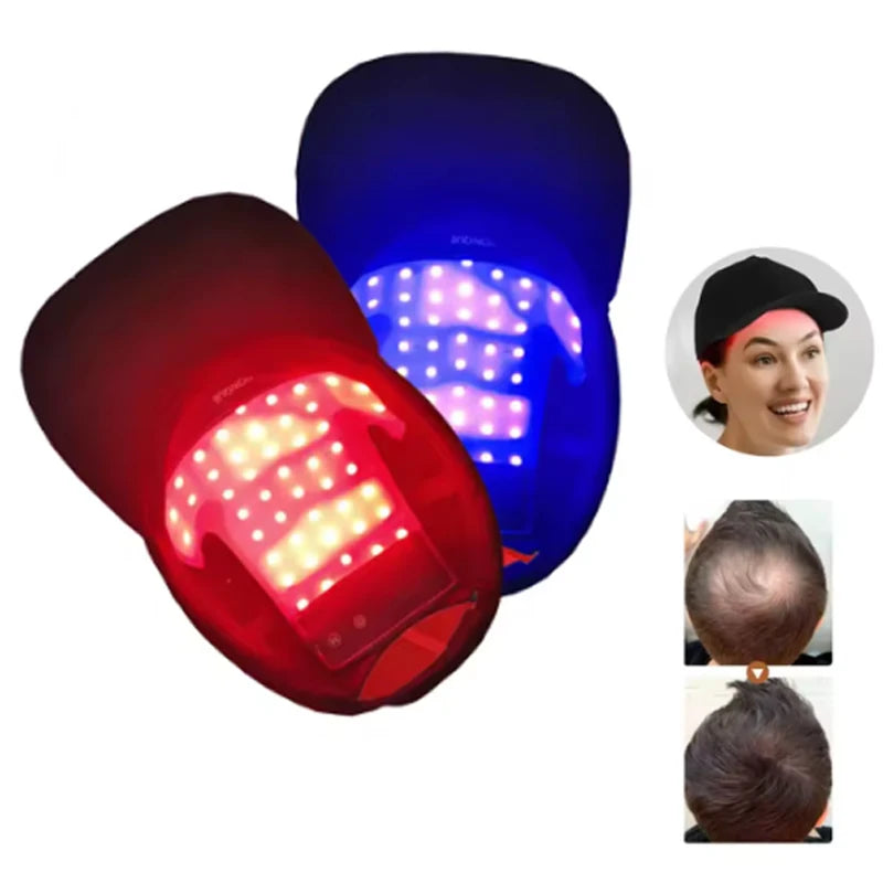 LED Red Light Therapy Cap Hair Growth Helmet Diode LaserHat Light Therapy Cap for Hair Regrowth and Hair Loss Treatment